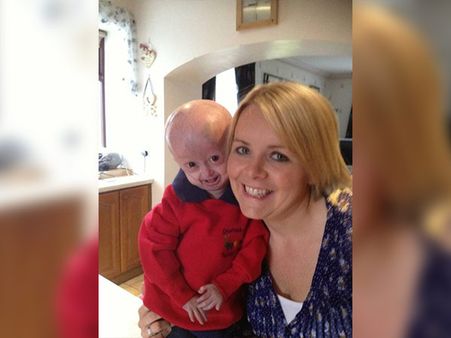 About The Condition About The Condition