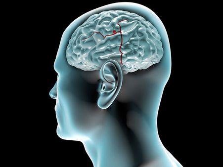 3. Good For The Brain