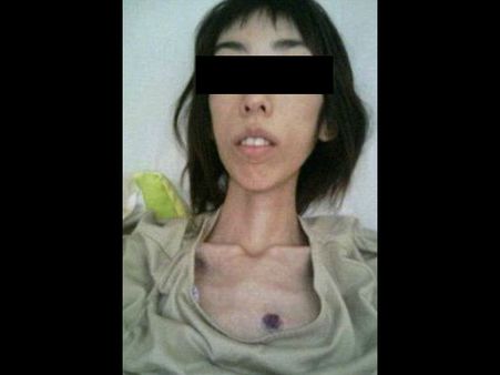 She Revealed About Her Abuse