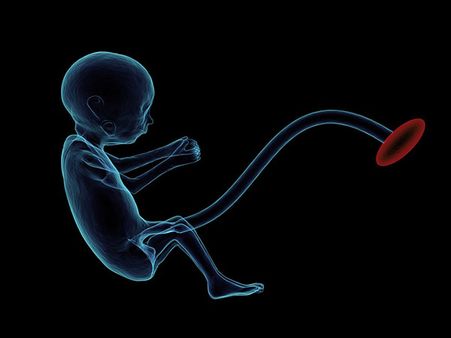 Mum Desired To Get Back Her Son's Sperm From Germany Mum Desired To Get Back Her Son's Sperm From Germany