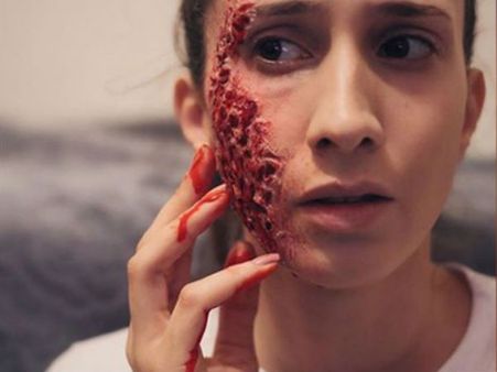 She Depicts The Acid Attack Victims