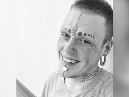 Eye Tattooing Can Be Risky!