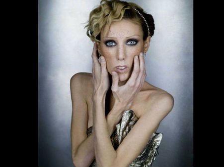 8. You Lost Weight Without Trying