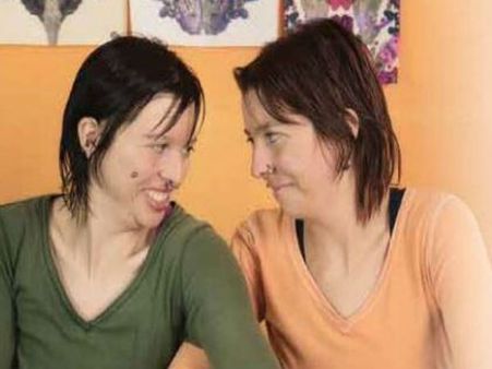 They Underwent A Surgery