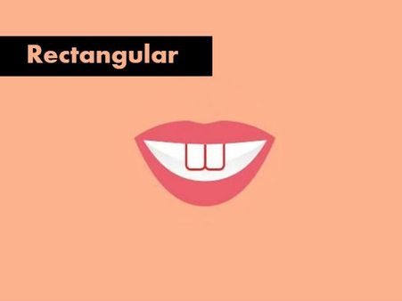 If You Have Rectangular-shaped Teeth…