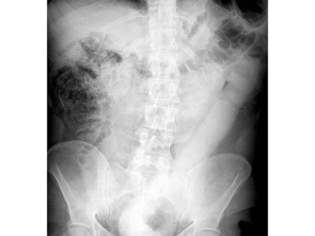 Doctors Tried Using...