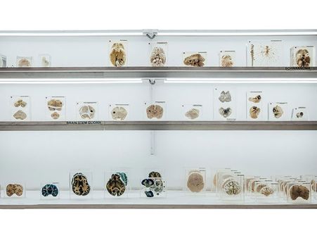 The Different Types Of Brain On Display The Different Types Of Brain On Display