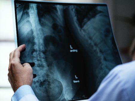 How Is It Diagnosed?