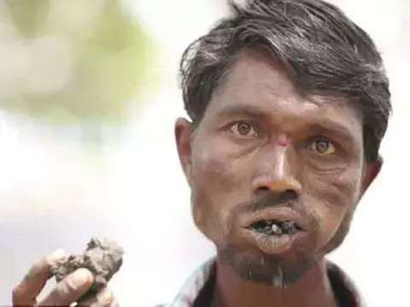 He Relishes Hot Charcoal Too! He Relishes Hot Charcoal Too!