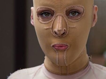 The Attacker Was A Jealous Woman