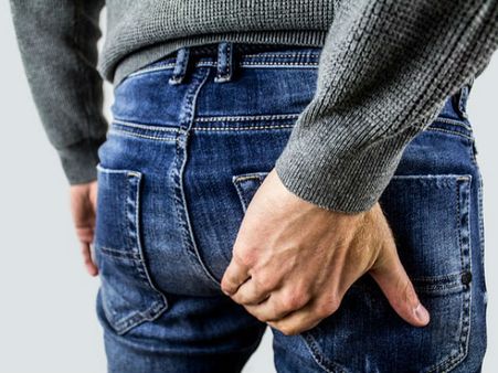 What Are Haemorrhoids?