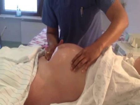 How Safe Is The Procedure?