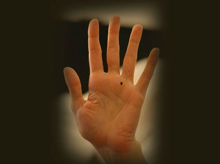 A Mole On The Index Finger