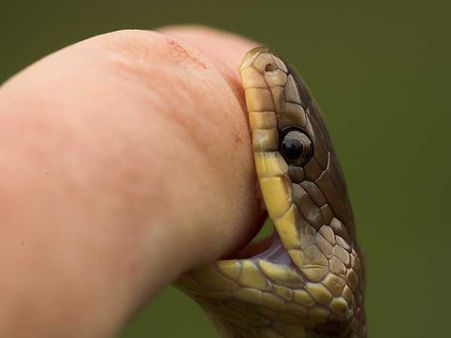 Symptoms Of A Venomous Bite