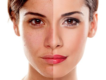 Treats Blemishes Treats Blemishes