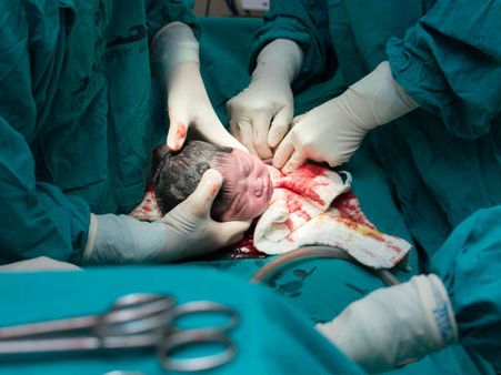 Why Is Vaginal Seeding Done?