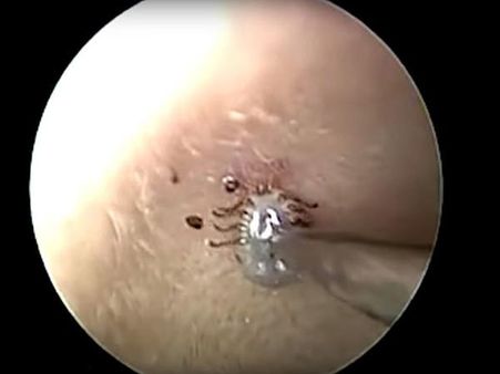 The Patient Was In A Lot Of Discomfort