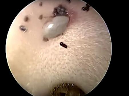 The Tick Was Swollen And Grey