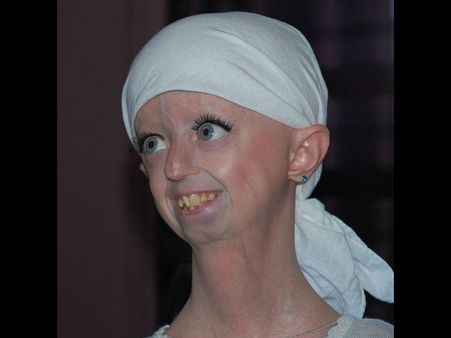 Despite Fighting Odds, She Lived Her Life To The Fullest