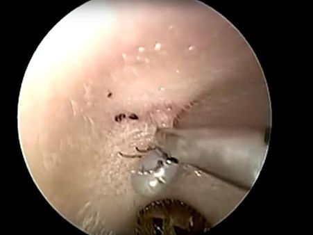 It Pulled Off A Small Piece Of Skin 