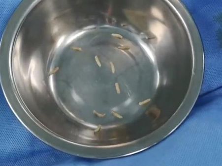 The Maggots Were Removed The Maggots Were Removed