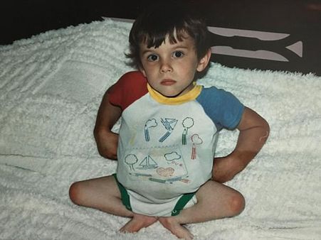 His Legs Were Amputated When He Was 3