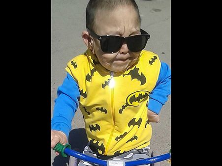 The Initial Symptoms Of His Condition Started With