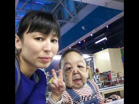 His Mum Wants Him To Undergo Surgery