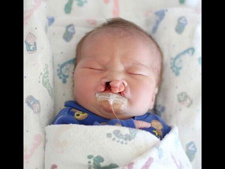 The Medics Asked The Couple If They Wanted To Keep The Baby 