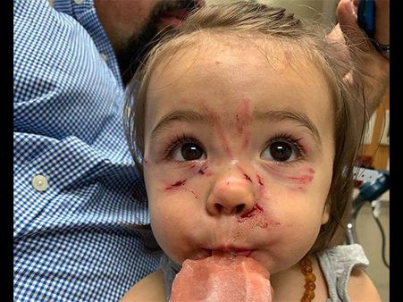 The Dog Attacked Their Daughter