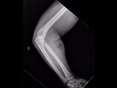 But Unfortunately, The Man Did Not Let The Medics Treat Him