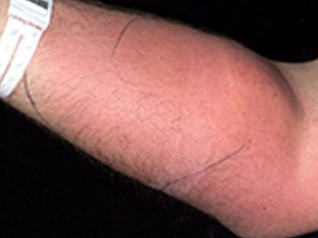 It Is Believed To Be The World’s First Bizarre Treatment