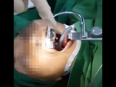 The Entire Bizarre Discovery Was Captured On Camera