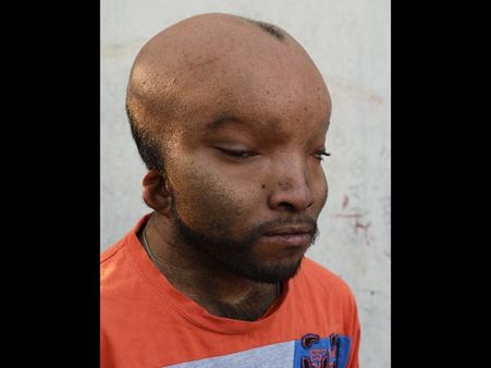 Medics Reveal His Condition To Be...