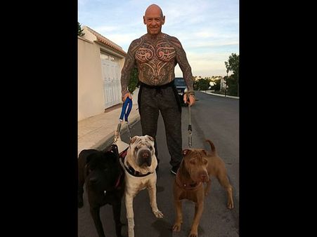 His Testicles Swelled Up 4 Times!