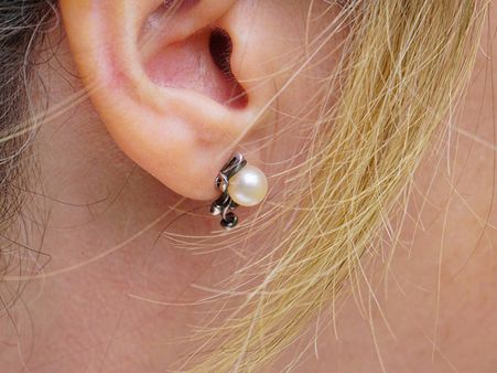 She Woke Up With This Condition