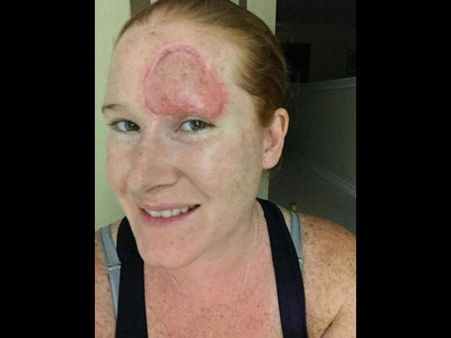 How Is This Condition Caused How Is This Condition Caused