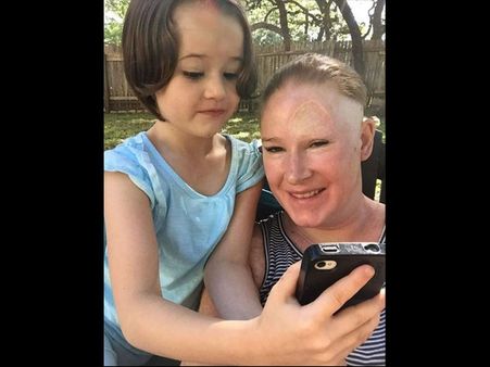 She Is Now Cancer-free! She Is Now Cancer-free!