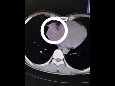 He Had The Habit Of Putting A Toothpick 