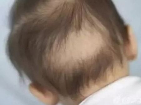 The Boy Used To Sweat And Jerk In His Sleep The Boy Used To Sweat And Jerk In His Sleep