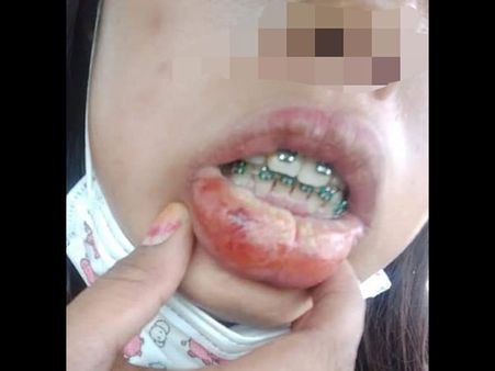 The Victim Chose A Cheap Dentist