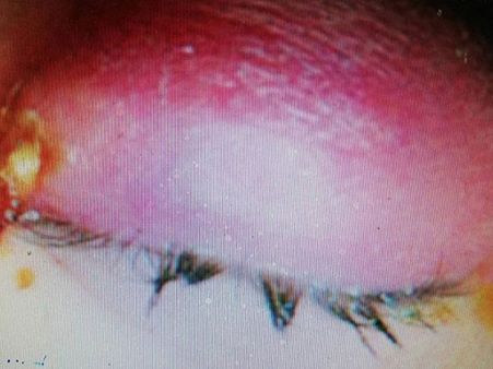 It Is Believed To Be The First Case In The World!