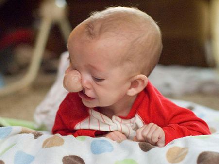 The Parents Were Advised To Abort The Pregnancy