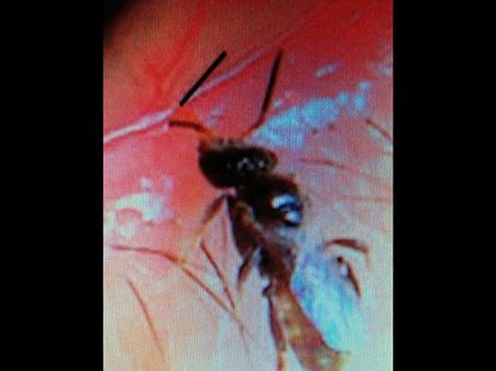 She Was Taken To The Hospital