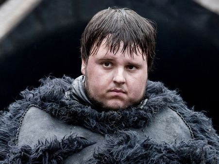 Samwell Tarly – Obesity Samwell Tarly – Obesity