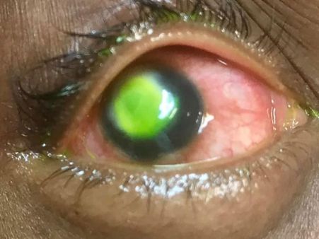 She Slept With Her Contacts In She Slept With Her Contacts In