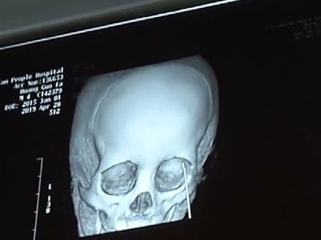 The Boy Was Lucky Enough