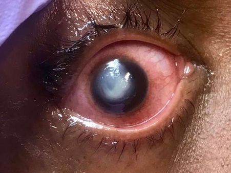 The Woman Might Face Lifelong Damage The Woman Might Face Lifelong Damage