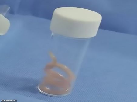 Cause Of Her Suffering Was Only Discovered Recently