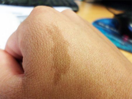 6. You Have Strange Birthmarks On Your Body 6. You Have Strange Birthmarks On Your Body